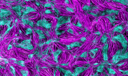 Bild zeigt ein 2D-Modell neuromuskulärer Verbindungen. Ein bestimmter Fluoreszensverfahren macht die Strukturen farblich in magenta und cyan sichtbar. Das Gewebe sieht aus wie viele ineinander verwobene Fäden.