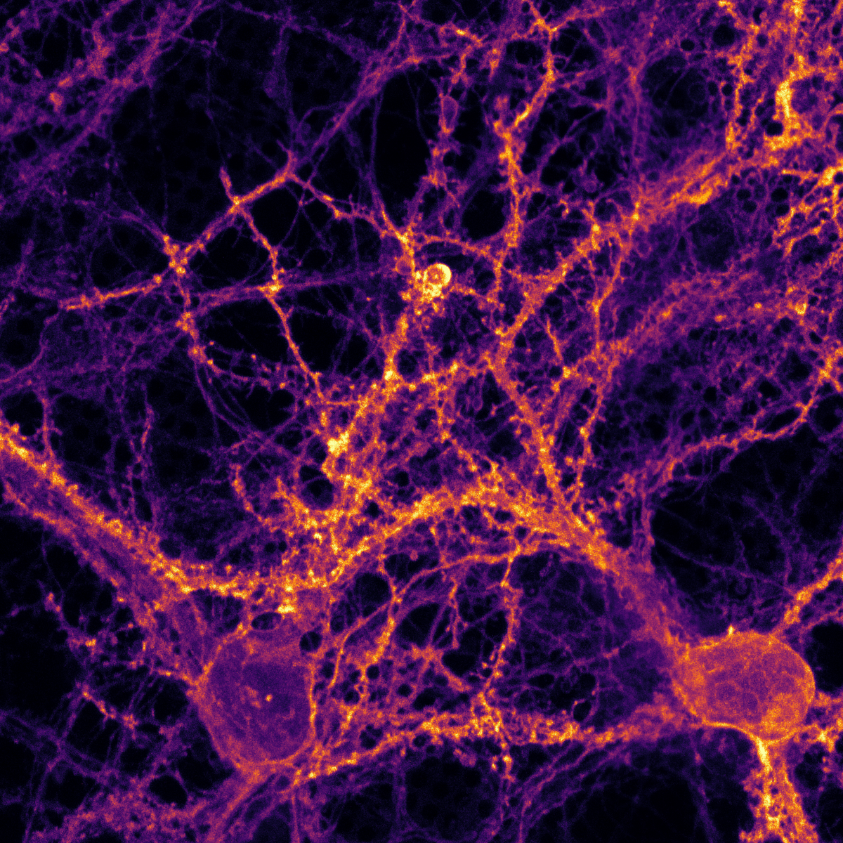 Nervenzellen beim Feuern zuzusehen – das ist dem Forschungsteam durch eine optogenetische Technik gelungen. Die Neuronen, hier in lila dargestellt, schütten auf einen Lichtimpuls hin Neurotransmitter aus, die Synapsen zwischen ihnen leuchten daraufhin gelb auf. Mittels Plunge Freezing fror das Team die Vorgänge ein und untersuchte die Ausschüttung der Botenstoffe im Detail.