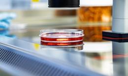 Promobild für die Nachricht: Am Max Delbrück Center entsteht das „Center for AI–Accelerated Molecular Innovations in Medicine“ - Gefäße mit Flüssigkeiten